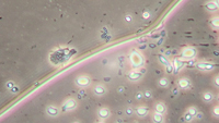 Amoeba by air bubble